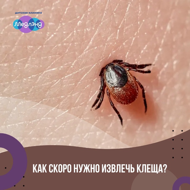 Как скоро нужно извлечь клеща?