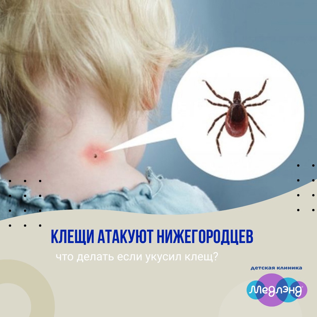 КЛЕЩИ АТАКУЮТ НИЖЕГОРОДЦЕВ